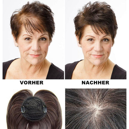 Hair Topper for Women, Clip In Topper Wig for Thinning Crown – image 4