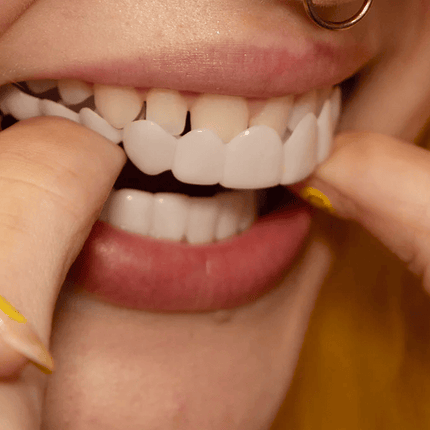 Snap On Veneers for Upper and Lower Teeth, Removable Teeth Veneers – image 8