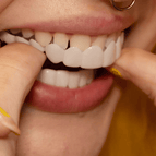 Upper & lower teeth