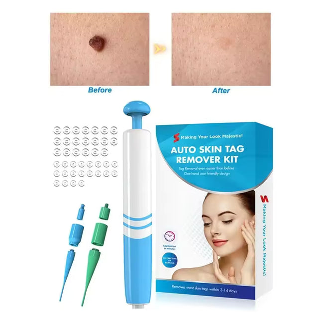 DermaLinx | Wart Remover for Pain-Free Skin Treatment | Effective Solution for Smooth Skin