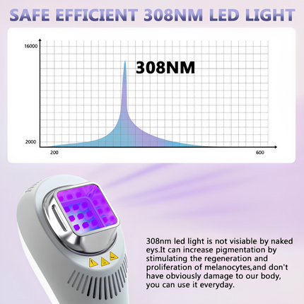 UVB Lamp 308nm for Home Use