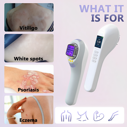 UVB Lamp 308nm for Home Use, Portable UVB Phototherapy Lamp