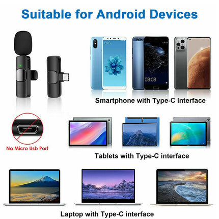 Ultra-Low Latency Wireless Microphone with Intelligent Noise Reduction | Easy Plug-and-Play for Live Broadcasts and Interviews