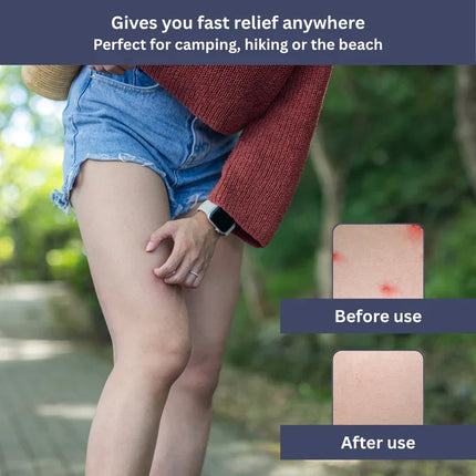 Anti Itch Cream for Bug Bites – image 8