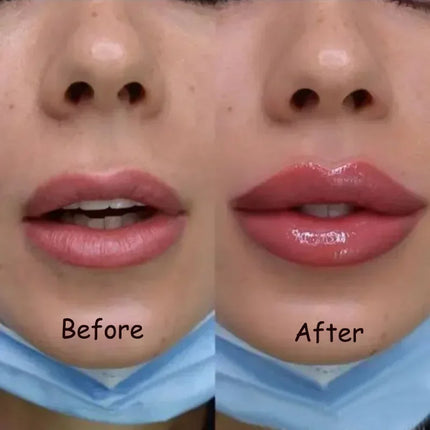Lip Plumper Serum, Instant Lip Plumping Serum with Cooling Tingle – image 5