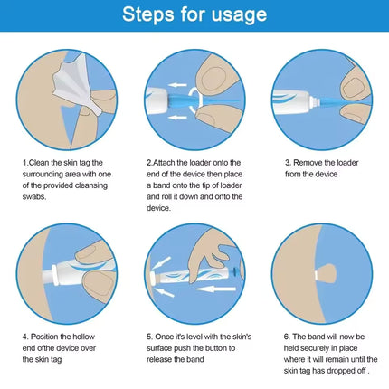 DermaLinx | Wart Remover for Pain-Free Skin Treatment | Effective Solution for Smooth Skin