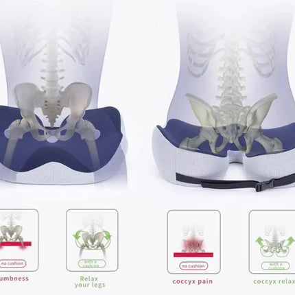 Seat Cushions, Pressure Relief Chair Cushion for Hips and Lower Back – image 5