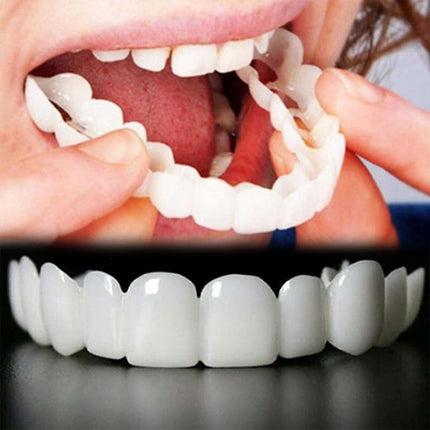Veneer Smile | Tooth Replacement Kit with Natural Look & Comfort | Easy-to-Use Solution for Perfect Teeth