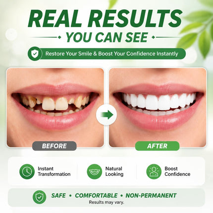 Veneer Smile | Tooth Replacement Kit with Natural Look & Comfort | Easy-to-Use Solution for Perfect Teeth