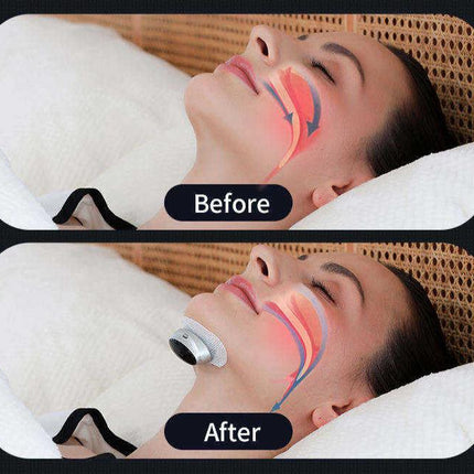 Anti Snoring Device, Rechargeable Snoring Solution for Sleep – image 7