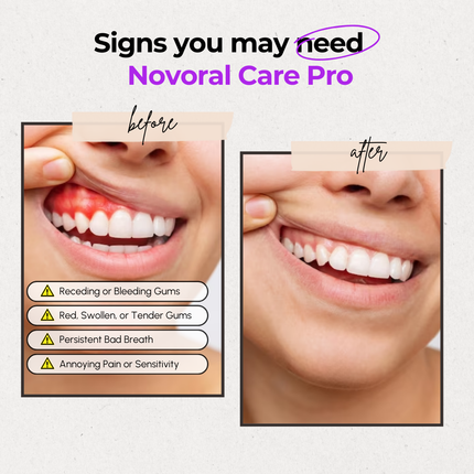 Red Light Therapy Device, Red Light Therapy for Gums with Blue Light and Teeth Tray – image 7