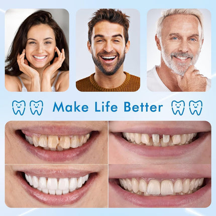 Vepine Moldable Silicone Dentures | Custom Fit False Teeth Set for Daily Use and Special Occasions