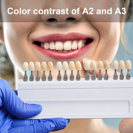 Vepine Dental Acrylic Resin Teeth | 112 Pcs Denture Set with Realistic A2 Shade | Perfect for Halloween & Daily
