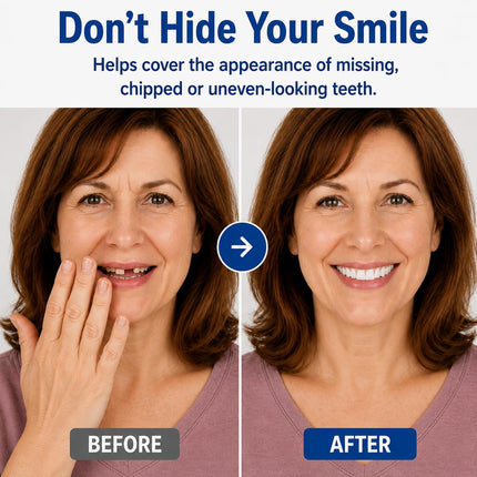 Vepine Custom Smile | Moldable False Teeth Set for Men & Women with Custom Fit | Temporary Easy Denture Kit for Missing & Chipped Teeth
