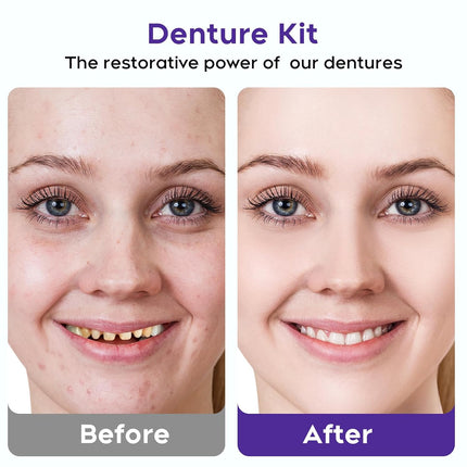 Vepine SmilePro | Complete Denture Kit with Natural-Looking Teeth | Easy Solution for Restoring Your Smile