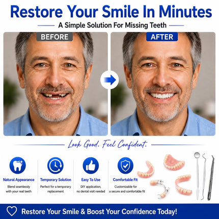 Vepine Complete Denture Set | Full & Partial Dentures with Easy-to-Use Tool Kit | Create Your Ideal Smile at Home