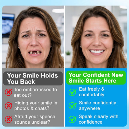 Vepine Custom Fit | Moldable Silicone Dentures with Natural Look | Comfortable Temporary Teeth for Daily Use & Special Occasions