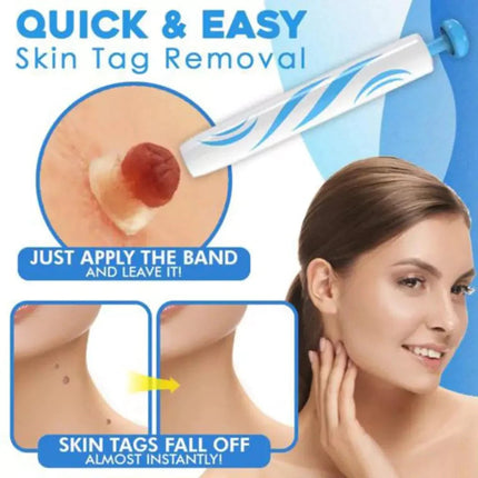 Aero Tag Remover Kit | Pain-Free Skin Tag Solution 3