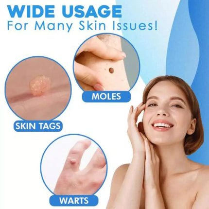 Aero Tag Remover Kit | Pain-Free Skin Tag Solution 4