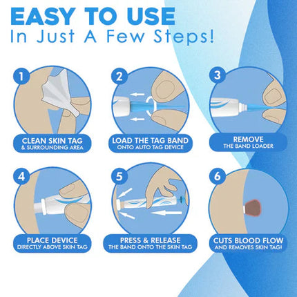 Aero Tag Remover Kit | Pain-Free Skin Tag Solution 6