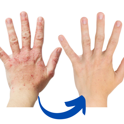 ArthroGlow | Infrared Therapy Gloves for Arthritis Pain Relief with Ergonomic Fit | Natural Solution for Improved Hand Function 2