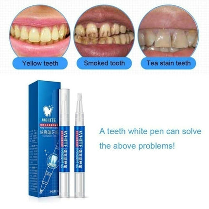 BrightSmile | Natural Tooth Whitening Gel Pen with Quick-Acting Formula | Portable Teeth Whitener for a Radiant Smile 3