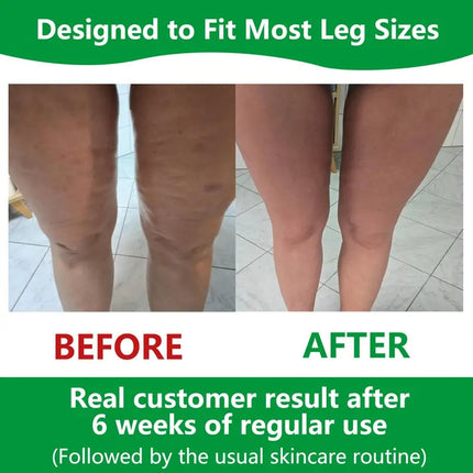 Cellulite Roller | 360° Deep-Tissue Massage Tool with Adjustable Width | Enhance Circulation for Toned Legs 5