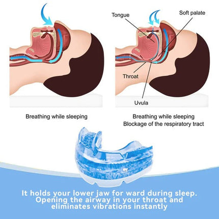 ComfortGuard | Adjustable Anti-Snoring Mouth Guard with Custom Fit | Non-Invasive Solution for Quieter Sleep 2