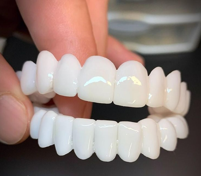 DentAlign | Snap On Teeth Veneers with Custom Fit for Natural Smile 0