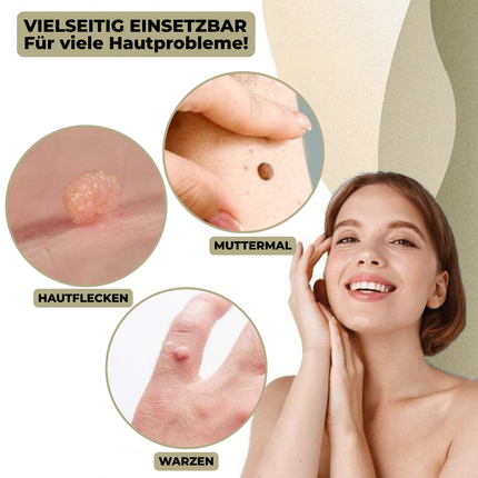DermaLinx | Wart Remover for Pain-Free Skin Treatment | Effective Solution for Smooth Skin 1