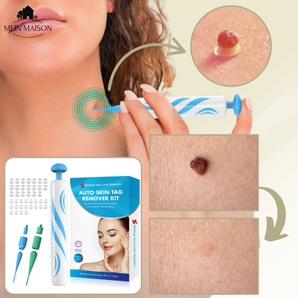DermaLinx | Wart Remover for Pain-Free Skin Treatment | Effective Solution for Smooth Skin 5