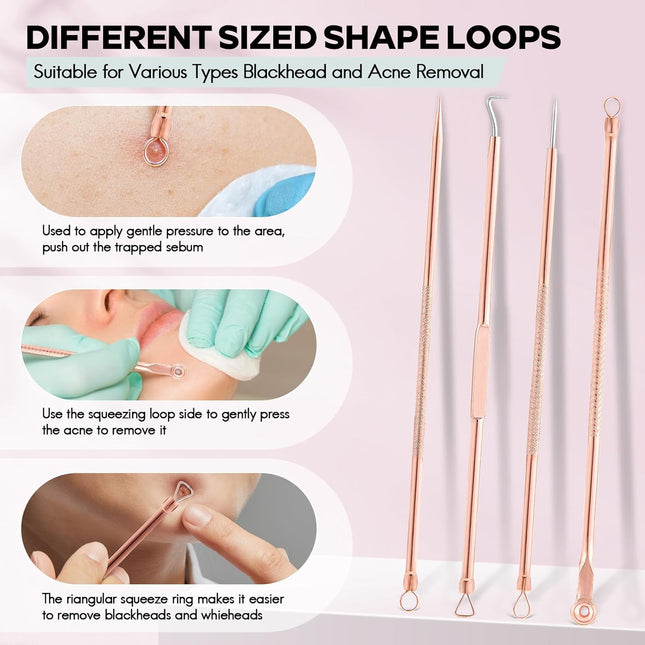 Essential Blackhead & Pimple Extractor Kit with Protective Case for Flawless Skin 1
