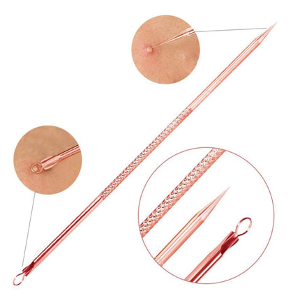 Essential Skin Care | Pimple Extractor Tool Kit with Safe Stainless Steel | Professional Blackhead Removal for Clear Complexion 6
