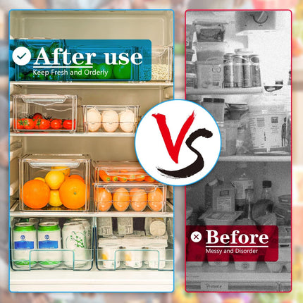 FridgeMaster | Stackable Fridge Organizer Containers with Secure Lids | BPA-Free Bins for Efficient Refrigerator Organization 5