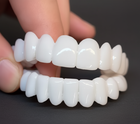 Snap On Veneers, Cosmetic Veneers for Broken or Crooked Teeth, Removable Teeth Cover for Yellowed or Missing Teeth