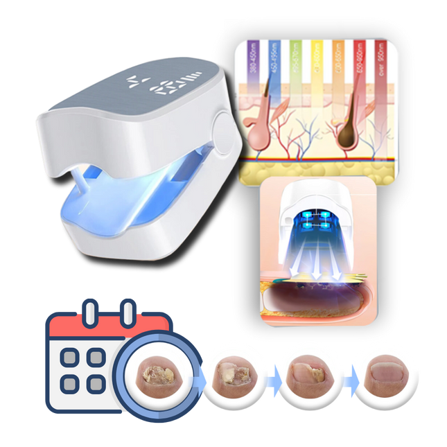 Nail Health Laser | Advanced Dual Laser Treatment Device for Fungus | Portable Non-Invasive Care for All Ages 1