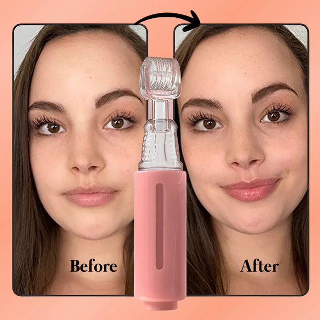 Natural Lip Plumper Kit | Gentle Formula for Fuller Lips | Boost Confidence with Easy Use 0