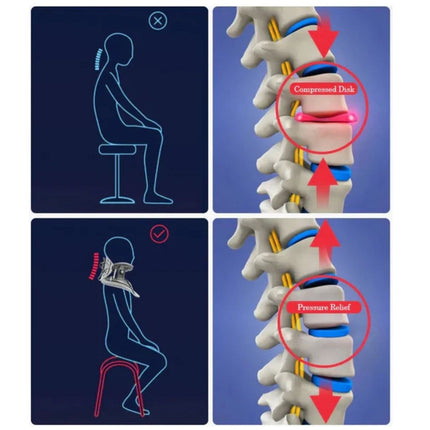 Neck Stretcher | Adjustable Cervical Traction Device for Pain Relief | Ergonomic Design for Improved Posture 2