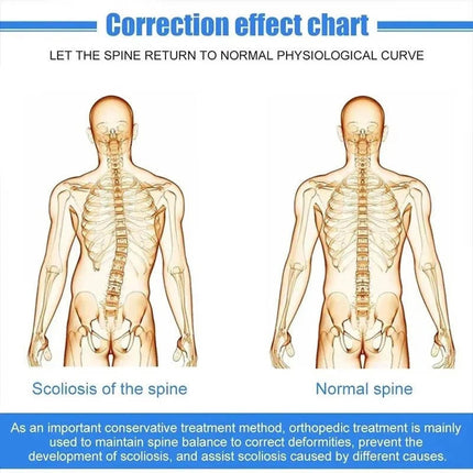 Posture Pro | Customizable Spinal Alignment Support with Adjustable Fit | Enhanced Comfort for Daily Use 2