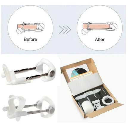 Pro Extender | Adjustable Traction Device with Durable Materials | Gentle Support for Natural Tissue Adaptation 5