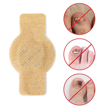 Nail Repair Patches for Toenails and Fingernails – image 6
