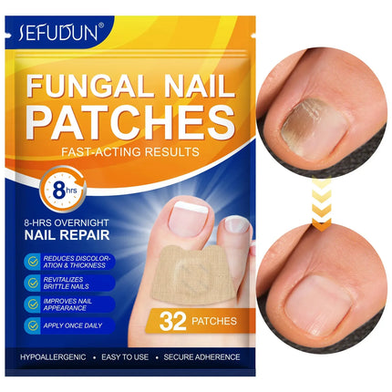 Nail Repair Patches for Toenails and Fingernails, Nail Fungus Patches with Tea Tree Oil – image 4