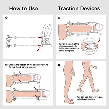 Male Enhancement Traction System – image 8