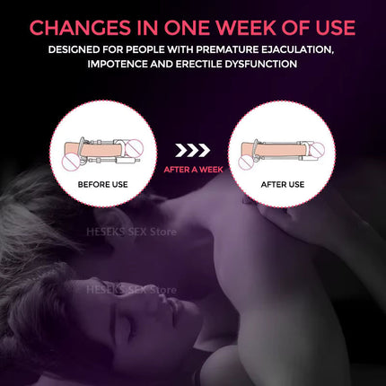 Penile Traction Device for Men, Male Enhancement Traction System – image 12