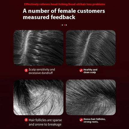 Scalp Massager for Hair Growth with Microcurrent & Red Light Therapy | Stimulate Follicles for Thicker, Healthier Hair 3