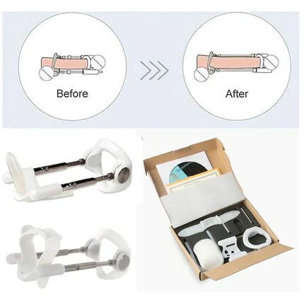 Penile Traction Device for Men, Penile Extender with Adjustable Tension Screws – image 5