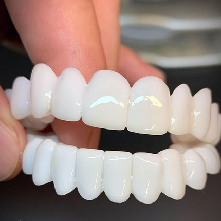 SmileLift | Dental Prosthesis with Customizable Lenses for Natural Look | Comfortable Fit for Confident Smiles 1