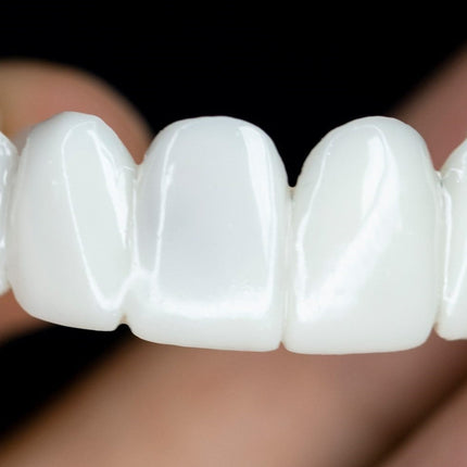 SmileLift | Dental Prosthesis with Customizable Lenses for Natural Look | Comfortable Fit for Confident Smiles 3