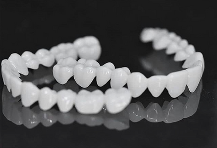 SmileLift | Dental Prosthesis with Customizable Lenses for Natural Look | Comfortable Fit for Confident Smiles 4