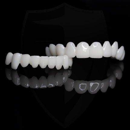 SmileLift | Dental Prosthesis with Customizable Lenses for Natural Look | Comfortable Fit for Confident Smiles 5